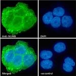 NUMB Antibody in Immunocytochemistry (ICC/IF)