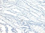 NUMB Antibody in Immunohistochemistry (Paraffin) (IHC (P))