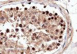 RACGAP1 Antibody in Immunohistochemistry (Paraffin) (IHC (P))