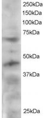 TRF1 Antibody in Western Blot (WB)