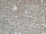 STUB1 Antibody in Immunohistochemistry (Paraffin) (IHC (P))