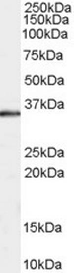 STUB1 Antibody in Western Blot (WB)