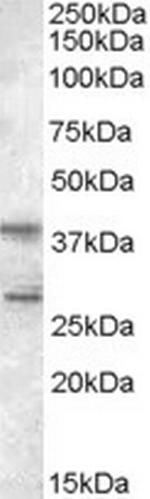 SKAP2 Antibody in Western Blot (WB)