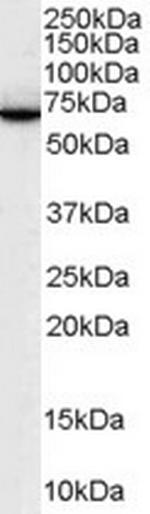 SWAP70 Antibody in Western Blot (WB)