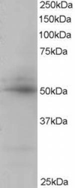 CREB3L4 Antibody in Western Blot (WB)