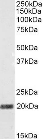 STMN2 Antibody in Western Blot (WB)