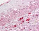 DAP3 Antibody in Immunohistochemistry (Paraffin) (IHC (P))