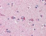 LIS1 Antibody in Immunohistochemistry (Paraffin) (IHC (P))