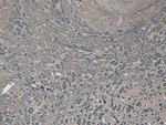 BAG3 Antibody in Immunohistochemistry (Paraffin) (IHC (P))