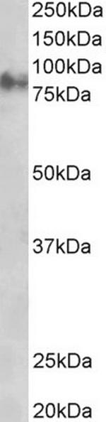 gamma Catenin Antibody in Western Blot (WB)