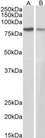 gamma Catenin Antibody in Western Blot (WB)