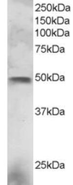 ELF3 Antibody in Western Blot (WB)