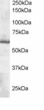 TrxR1 Antibody in Western Blot (WB)