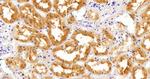 AKR1A1 Antibody in Immunohistochemistry (Paraffin) (IHC (P))