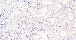 AKR1A1 Antibody in Immunohistochemistry (Paraffin) (IHC (P))