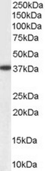 AKR1A1 Antibody in Western Blot (WB)