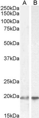 UBE2C Antibody in Western Blot (WB)