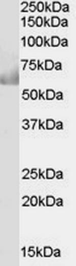 CDT1 Antibody in Western Blot (WB)