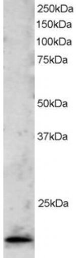 TBPL1 Antibody in Western Blot (WB)