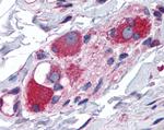 JWA Antibody in Immunohistochemistry (Paraffin) (IHC (P))