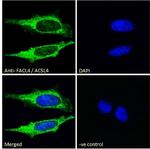 ACSL4 Antibody in Immunocytochemistry (ICC/IF)