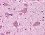 ACSL4 Antibody in Immunohistochemistry (Paraffin) (IHC (P))