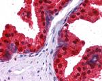 NDRG1 Antibody in Immunohistochemistry (Paraffin) (IHC (P))