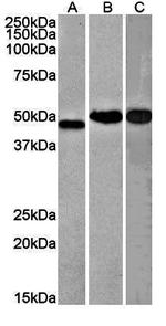 NDRG1 Antibody in Western Blot (WB)