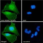 Blimp-1 Antibody in Immunocytochemistry (ICC/IF)