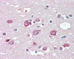 MLL4 Antibody in Immunohistochemistry (Paraffin) (IHC (P))