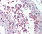 MLL4 Antibody in Immunohistochemistry (Paraffin) (IHC (P))