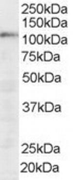 SART1 Antibody in Western Blot (WB)