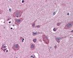 HIP2 Antibody in Immunohistochemistry (Paraffin) (IHC (P))