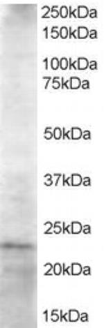 HIP2 Antibody in Western Blot (WB)