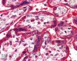 NEIL1 Antibody in Immunohistochemistry (Paraffin) (IHC (P))