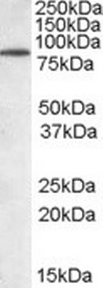 BERP Antibody in Western Blot (WB)