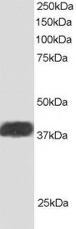 ALS2CR1 Antibody in Western Blot (WB)