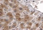 CLPP Antibody in Immunohistochemistry (Paraffin) (IHC (P))