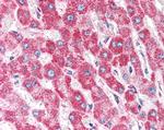 CLPP Antibody in Immunohistochemistry (Paraffin) (IHC (P))