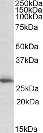 CLPP Antibody in Western Blot (WB)