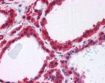 DJ-1 Antibody in Immunohistochemistry (Paraffin) (IHC (P))