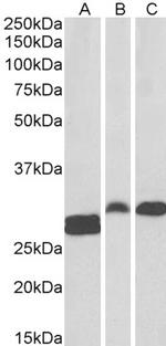 PHAPI2 Antibody in Western Blot (WB)