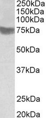 RNF139 Antibody in Western Blot (WB)