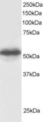 GPS1 Antibody in Western Blot (WB)