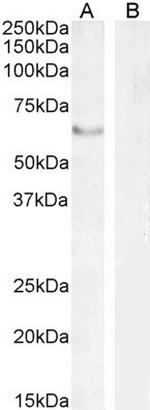 FOXC2 Antibody in Western Blot (WB)