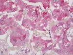 FOXL2 Antibody in Immunohistochemistry (Paraffin) (IHC (P))