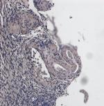 FOXL2 Antibody in Immunohistochemistry (Paraffin) (IHC (P))