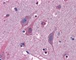 MYRIP Antibody in Immunohistochemistry (Paraffin) (IHC (P))