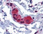 MYRIP Antibody in Immunohistochemistry (Paraffin) (IHC (P))