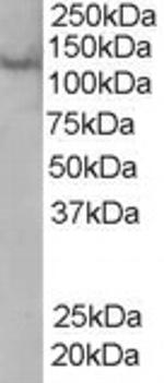 Rabenosyn 5 Antibody in Western Blot (WB)